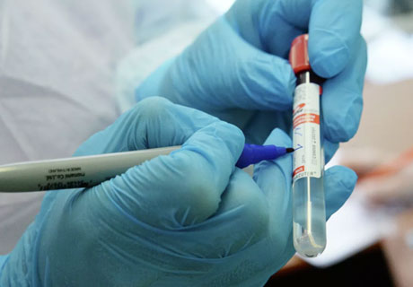MARȚI, ÎN MOLDOVA, AU FOST ÎNREGISTRATE 650 DE CAZURI NOI DE INFECȚIE CU COVID-19, IAR 19 PERSOANE AU MURIT MARȚI, ÎN MOLDOVA, AU FOST ÎNREGISTRATE 650 DE CAZURI NOI DE INFECȚIE CU COVID-19, IAR 19 PERSOANE AU MURIT