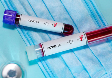 LUNI, ÎN MOLDOVA AU FOST ÎNREGISTRATE 107 CAZURI NOI DE CORONAVIRUS, IAR TREI PERSOANE AU DECEDAT LUNI, ÎN MOLDOVA AU FOST ÎNREGISTRATE 107 CAZURI NOI DE CORONAVIRUS, IAR TREI PERSOANE AU DECEDAT