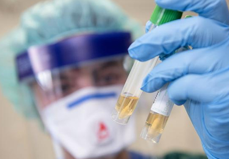 ÎN MOLDOVA AU FOST ÎNREGISTRATE 16 250 CAZURI DE INFECTARE CU CORONAVIRUS ÎN MOLDOVA AU FOST ÎNREGISTRATE 16 250 CAZURI DE INFECTARE CU CORONAVIRUS