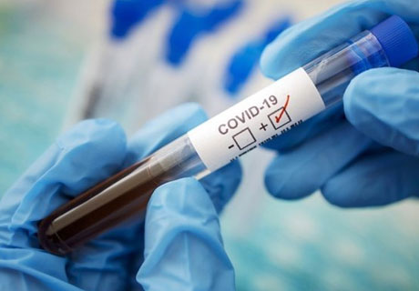 SĂPTĂMÂNA TRECUTĂ S-AU ÎNREGISTRAT CIFRE RECORD DE INFECTARE ŞI DE DECESE CAUZATE DE COVID-19 SĂPTĂMÂNA TRECUTĂ S-AU ÎNREGISTRAT CIFRE RECORD DE INFECTARE ŞI DE DECESE CAUZATE DE COVID-19
