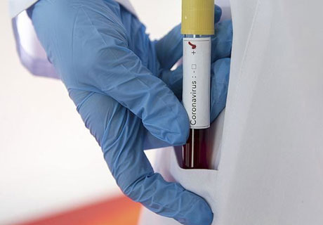 HEALTH MINISTER REPORTS CORONAVIRUS NEWS: +35 = 298 HEALTH MINISTER REPORTS CORONAVIRUS NEWS: +35 = 298